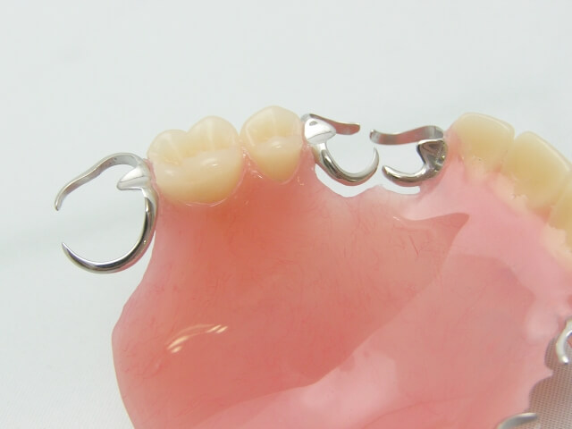 入れ歯の材質と特徴
