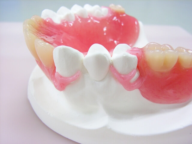 入れ歯の主な種類は8つ