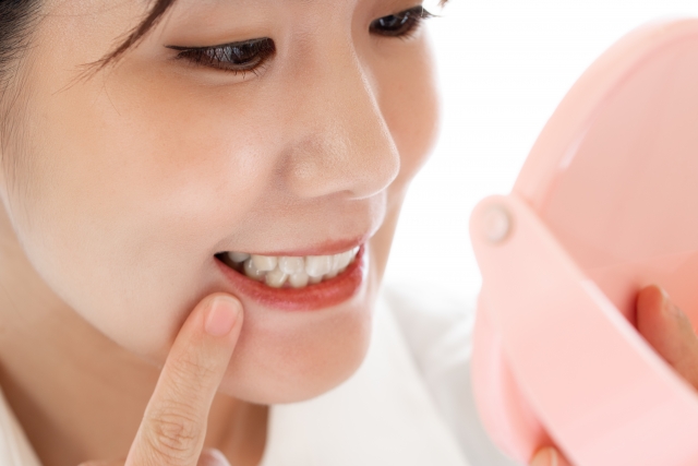 入れ歯以外の治療方法における値段の目安