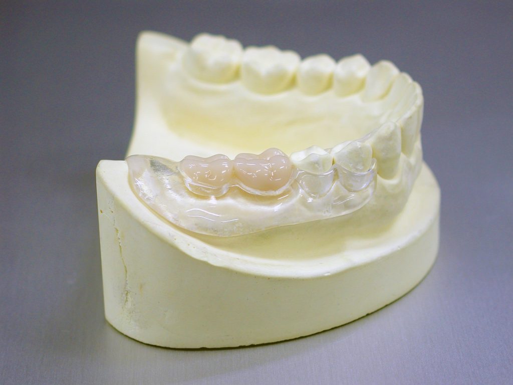 奥歯の入れ歯について知っておくべき3つのこと