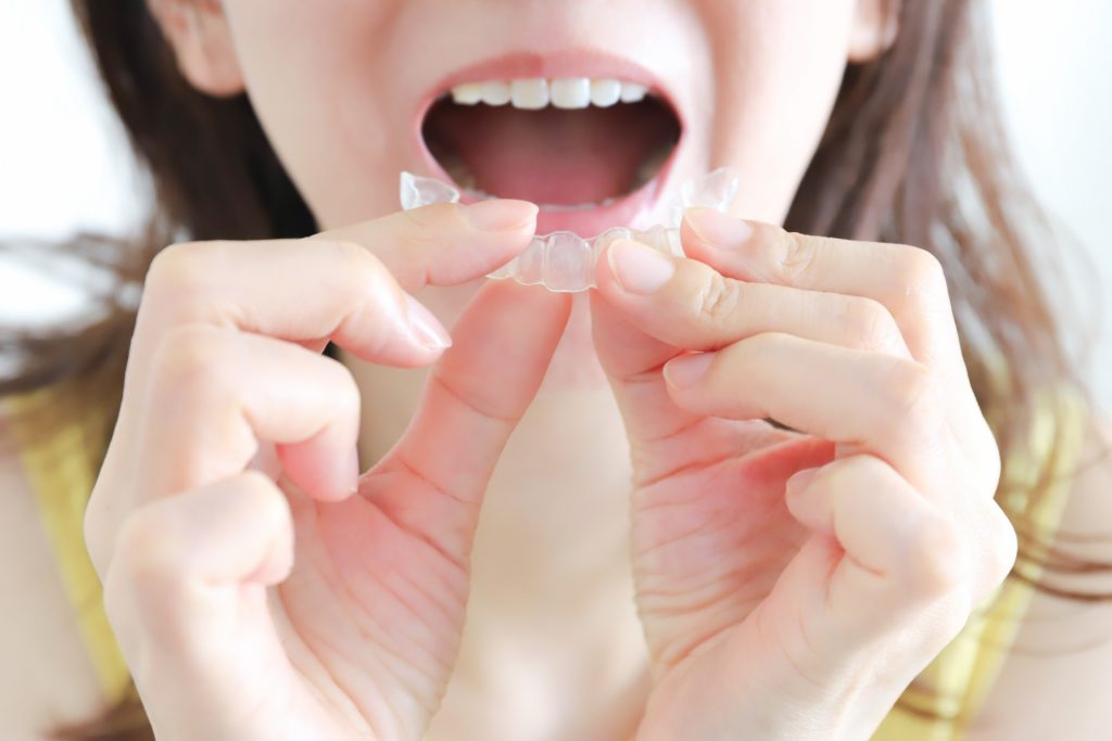 マウスピース矯正中の虫歯予防策は7つ