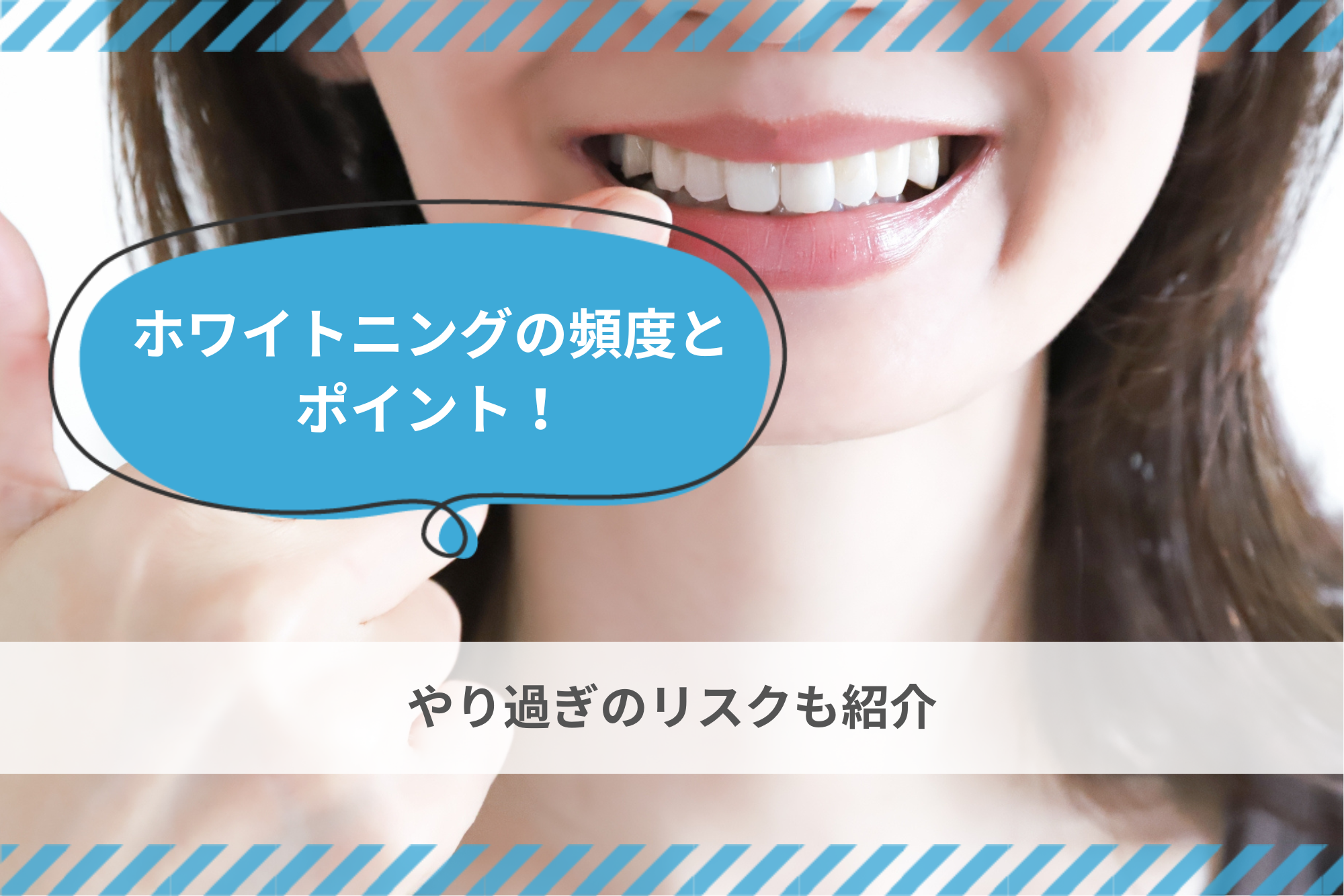 ホワイトニングの頻度とポイント！やり過ぎのリスクも紹介 - 歯科技工