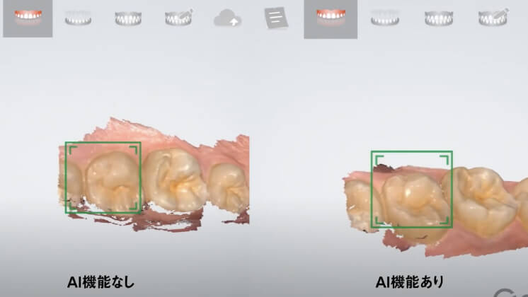 AI機能
